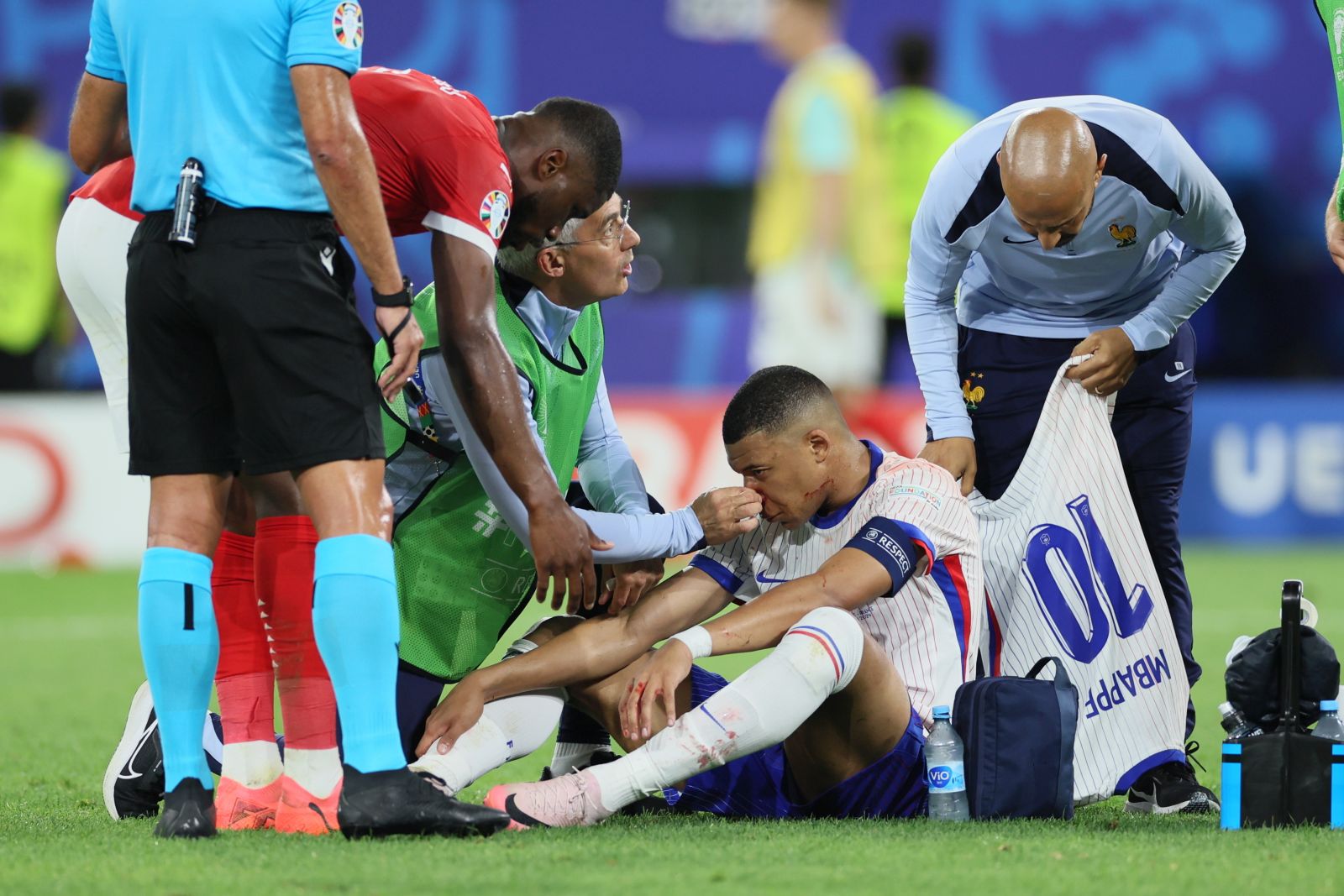 epa11418952 Kylian Mbappe of France receives treatment during the UEFA EURO 2024 group D soccer match between Austria and France, in Duesseldorf, Germany, 17 June 2024.  EPA/Leszek Szymanski POLAND OUT